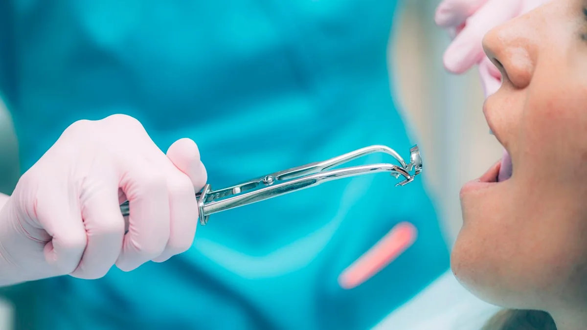Instrumental de endodoncia preparado junto a la boca del paciente
